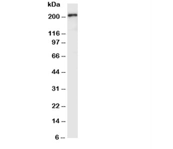 Western blot testing with VEGFR2 antibody and SMMC-7721 lysate. Predicted molecular weight: ~152 (im
