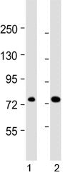 ABCD1 antibody western blot analysis in human 1) 293/T17 and 2) HL-60 lysate. Predicted molecular we
