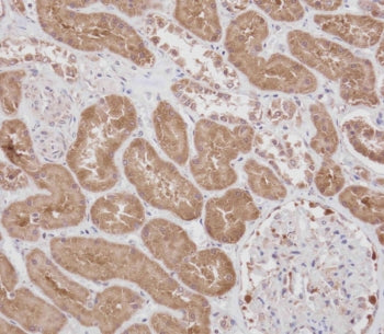 IHC testing of FFPE human kidney tissue with RPS18 antibody. HIER: steam section in pH9 EDTA for 20 