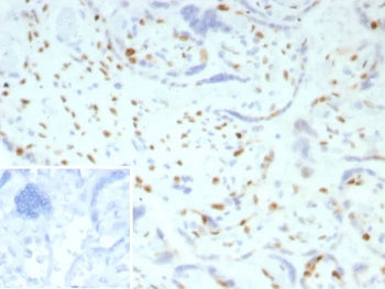 IHC staining of FFPE human placental tissue with p57Kip2 antibody (clone KIP2/7186). Inset: PBS used