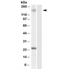 Western blot testing of HeLa lysate with GOLGA3 antibody at 0.1ug/ml. Predicted/observed molecular w