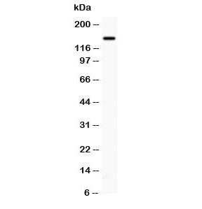 Western blot testing of P-Selectin antibody and PANC lysate; The protein is visualized from 86~140 k