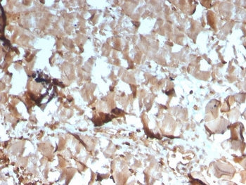 IHC staining of FFPE human skeletal muscle tissue with Creatine Kinase M antibody (clone CKMM/3341).