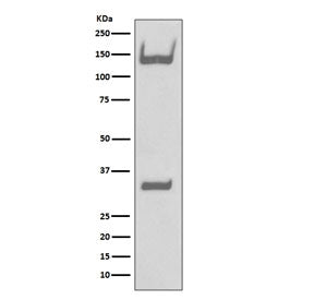 Western blot testing of human fetal brain lysate with TrkA/B/C antibody. Expected molecular weight: 