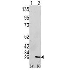 Western blot analysis of GRB2 antibody and 293 cell lysate (2 ug/lane) either nontransfected (Lane 1