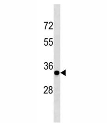Cyclin D3 Antibody (CCND3)