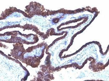 Cytokeratin 8/18 Antibody Cocktail