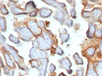 IHC testing of FFPE human placenta with hCG beta antibody (clone SPM105). Required HIER: boil tissue