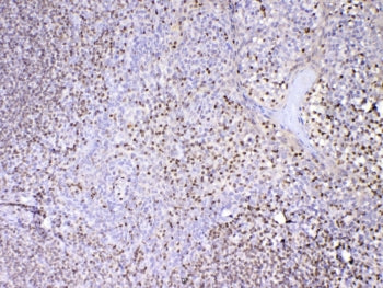 IHC testing of FFPE human tonsil tissue with PAX5 antibody at 1ug/ml. Required HIER: steam section i