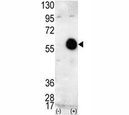 Western blot analysis of AKT2 antibody and 293 cell lysate (2 ug/lane) either nontransfected (Lane 1