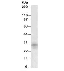 Western blot testing of mouse kidney lysate with IGFBP7 antibody at 1ug/ml. Predicted molecular weig