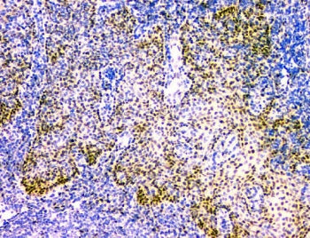 IHC staining of FFPE human tonsil with NFIA antibody. HIER: boil tissue sections in pH8 EDTA for 20 