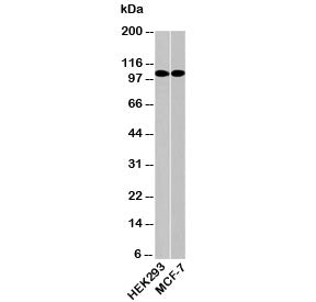 Western blot testing of human samples with LSD1 antibody at 0.5ug/ml. Expected molecular weight ~110
