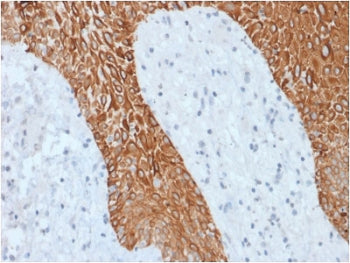 Multi Cytokeratin Antibody