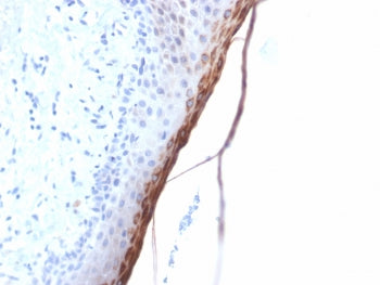 Filaggrin Antibody