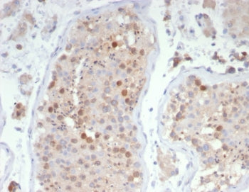 KIF2C Antibody / MCAK