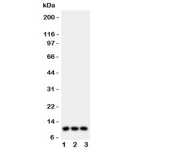 Western blot testing of CCL1 antibody and Lane 1: U87; 2: MCF-7; 3: COLO320 lysate. Expected/observe
