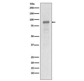 Western blot testing of human Jurkat cell lysate with HSP90AA1 antibody. Predicted molecular weight: