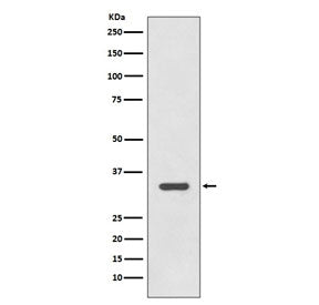 Western blot testing of human Raji cell lysate with HLA-DR antibody. Expected molecular weight ~34 k