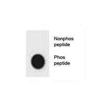 Dot blot analysis of phospho-CDKN2A antibody. 50ng of phos-peptide or nonphos-peptide per dot were s