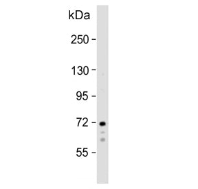 Western blot testing of human Raji cell lysate with Spleen tyrosine kinase antibody. Predicted molec