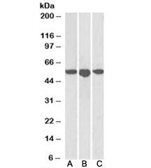 Western blot testing of human breast [A], placenta [B] and spleen [C] lysates with ENT1 antibody at 