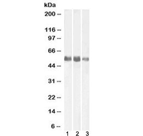 Western blot testing of human 1) kidney, 2) lung and 3) adrenal gland lysate with Alkaline Phosphata