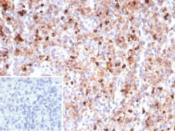 MPO Antibody / Myeloperoxidase