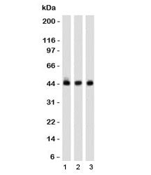 Western blot of 1) K562, 2) 293 and 3) A549 cell lysates using Napsin A antibody (clone NPSNA-1). Ex