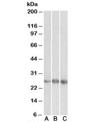 Western blot testing of human heart [A], kidney [B] and lung [C] lysates with EGFL7 antibody at 1ug/