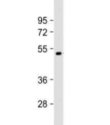 Western blot testing of human NCI-H1299 cell lysate with Factor VII antibody at 1:2000. Predicted mo