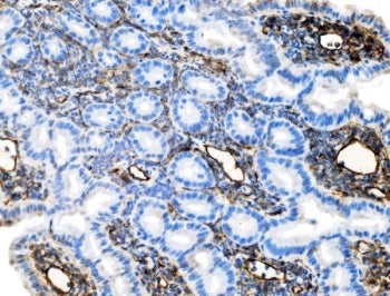 IHC staining of FFPE mouse intestine tissue with Icam1 antibody. HIER: boil tissue sections in pH8 E