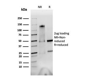 Integrin alpha V + beta 6 Antibody