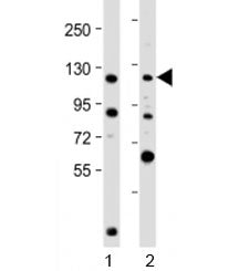 Western blot testing of human 1) K562 and 2) U-2OS cell lysate with NOP2 antibody at 1:2000. Predict