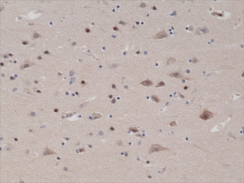 IHC testing of FFPE human brain tissue with recombinant PTEN antibody at 1:1000.