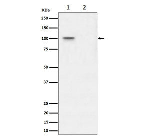 Western blot testing of lysate from human 293T cells, untreated (1) and Lambda Phosphatase treated (