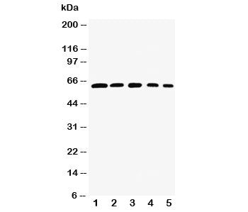 Western blot testing of RelB antibody and Lane 1: rat testis; 2: (h) HeLa; 3: (m) NIH3T3; 4: (h) Raj