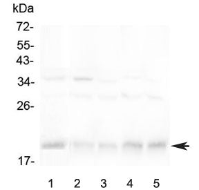 Western blot testing of 1) human Jurkat, 2) rat spleen, 3) rat thymus, 4) mouse spleen and 5) mouse 