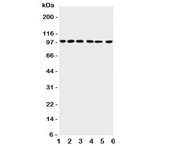 PIAS1 Antibody