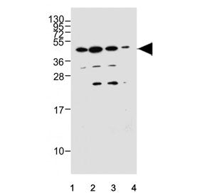 Western blot testing of human 1) MCF7, 2) T-47D, 3) SK-BR-3 and 4) HepG2 cell lysate with HCAR1 anti