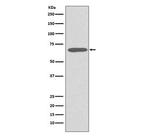 Western blot testing of human skin lysate with Keratin 1 antibody. Predicted molecular weight ~67 kD