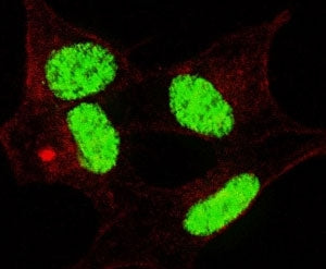 Fluorescent confocal image of SY5Y cells stained with phospho-LIN28 antibody. Alexa Fluor 488 conjug