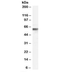 Western blot testing of human peripheral blood mononucleocyte lysate with VPS45 antibody at 0.3ug/ml