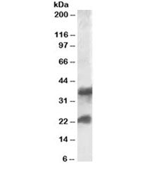 Western blot testing of human frontal cortex lysate with Clatherin Light Chain antibody at 0.1ug/ml. The expected molecular weight is 17~27 kDa. A ~35kDa band has also been reported (PMID: 10942733).