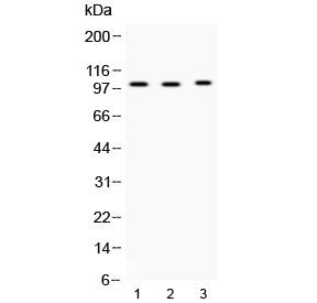 ADAM2 Antibody
