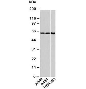 Western blot testing of human samples with HSP60 antibody at 1ug/ml.