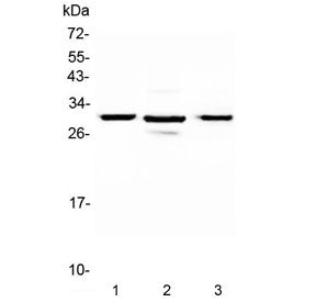 Western blot testing of 1) rat pancreas, 2) mouse pancreas and 3) human U-2 OS lysate with MED8 anti