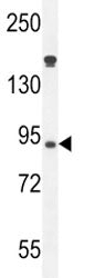 Myeloperoxidase Antibody (MPO)