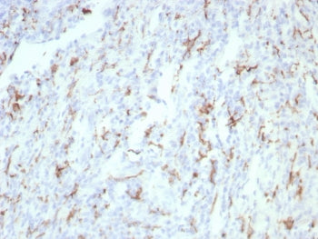 IHC staining of FFPE human tonsil tissue with CD163 antibody (clone rM130/8823). HIER: boil tissue s