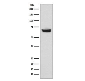 Western blot testing of human plasma lysate with CETP antibody. Expected molecular weight: 66-74 kDa